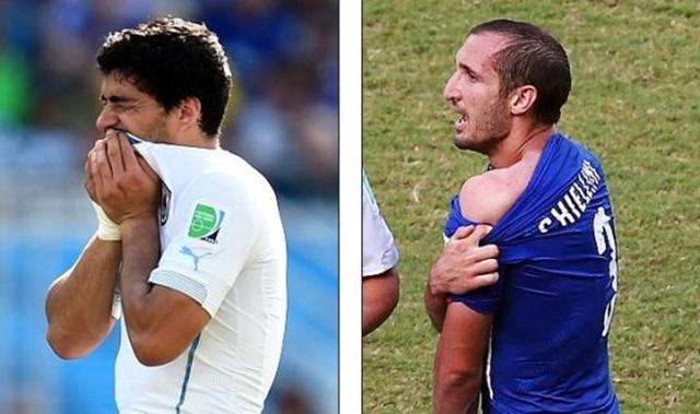 吕俊虎手臂 吕俊虎手臂